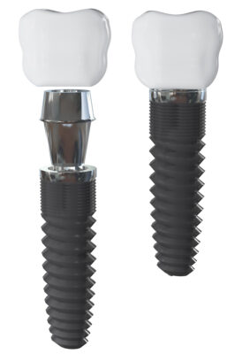 The two-step process of dental implants is illustrated.