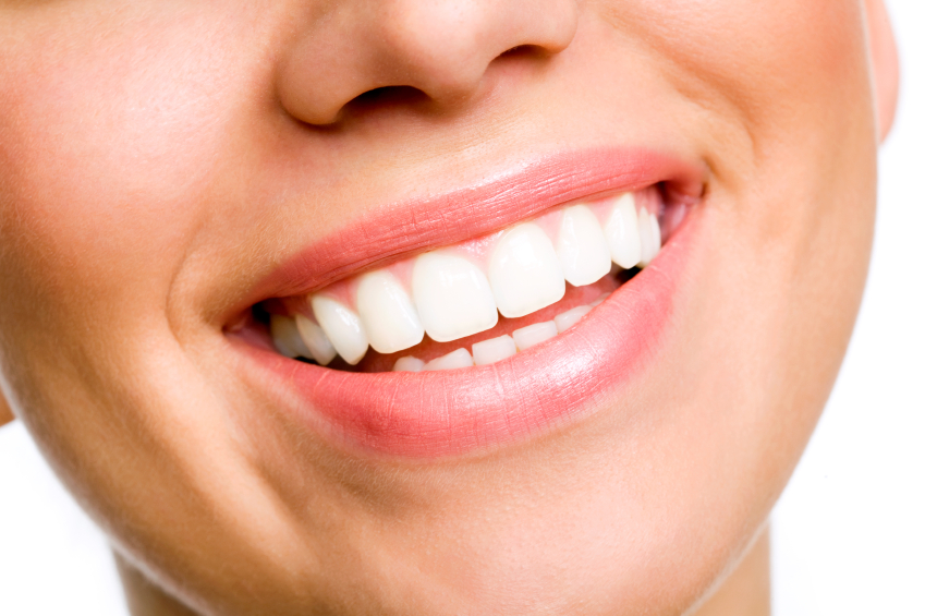 Are Porcelain Veneers Right for You?