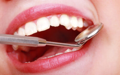 The First 100 Years with Dental Hygienists