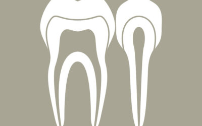 Tooth Saving Root Canal Therapy