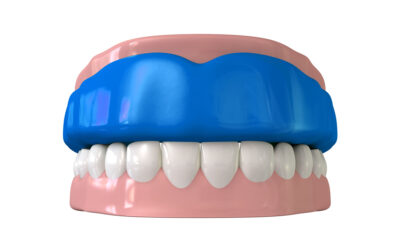 Caring for a Mouthguard