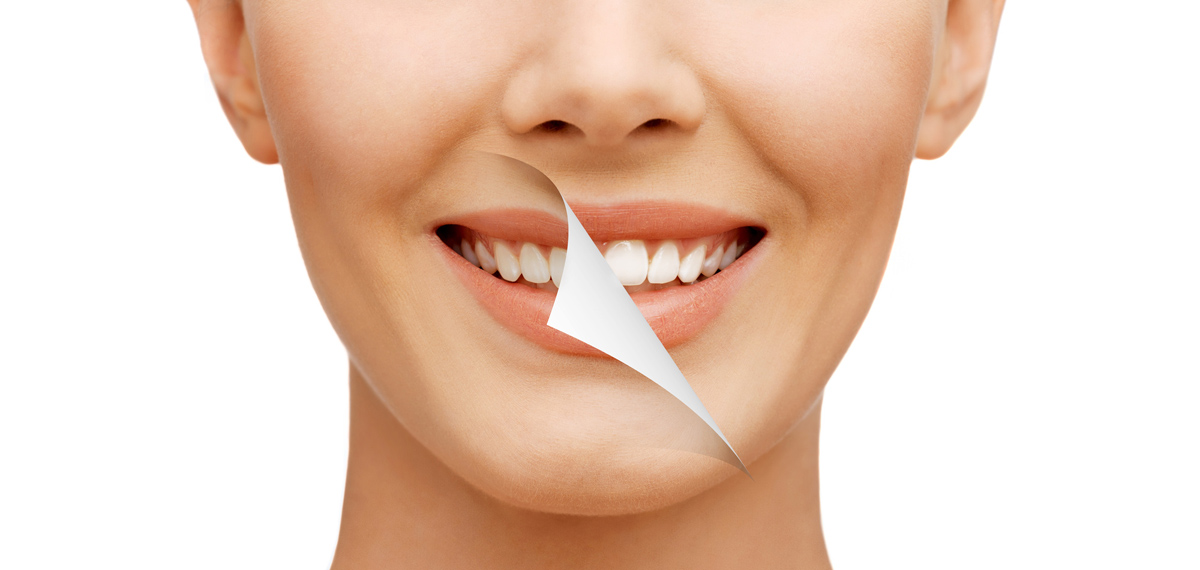 You may be able to whiten your teeth with steps that don't involve tooth whitening.