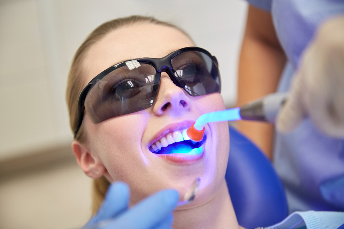 A UV light cures or hardens a dental resin applied during a tooth bonding procedure.