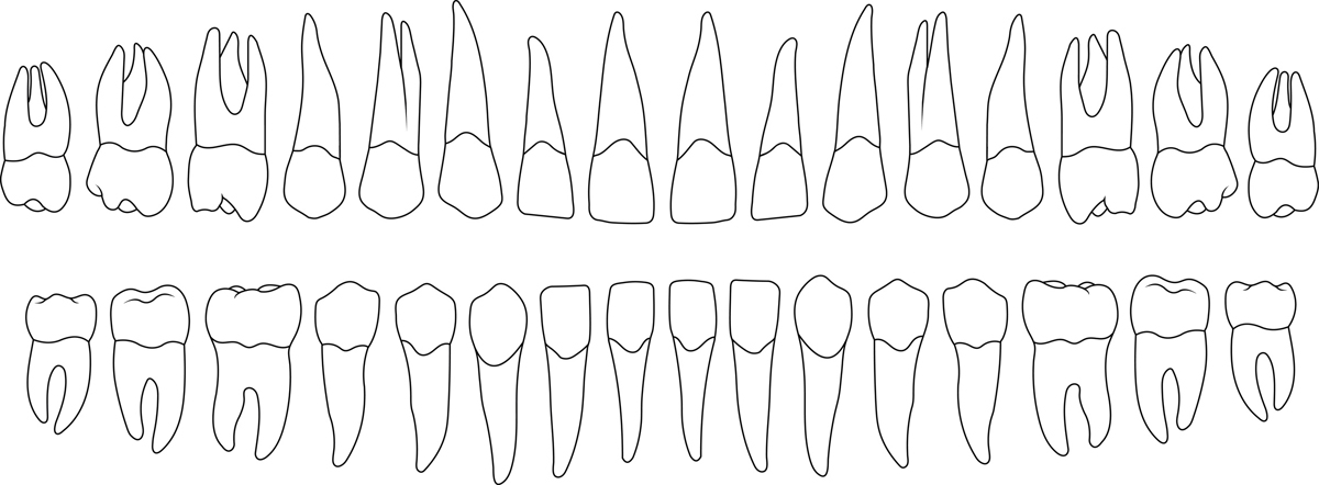 The 32 teeth found in ever person's mouth in Placerville, if they have them all.