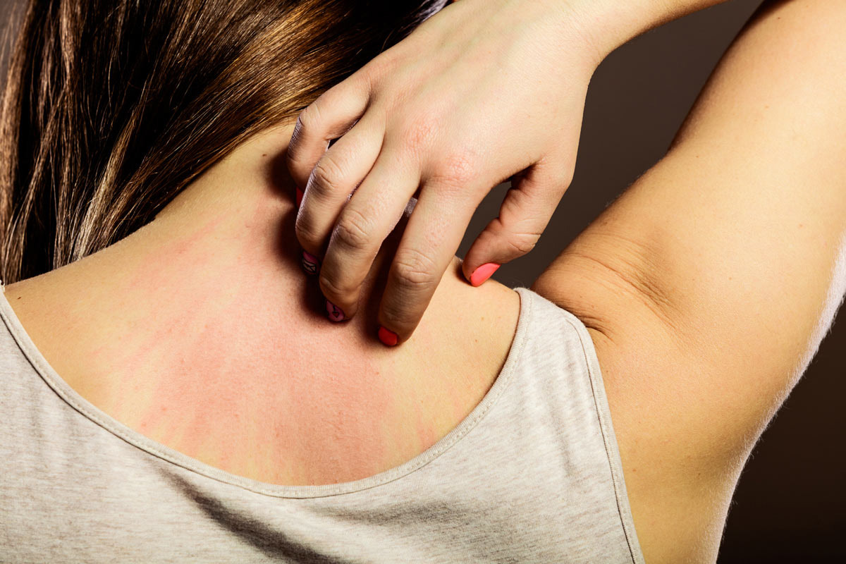 If you have psoriasis, it's important to make regular visits to our Placerville dentists to fight gum disease.