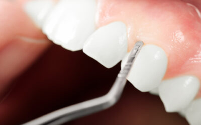 Tissue Issues and Pinhole Surgical Technique (PST)