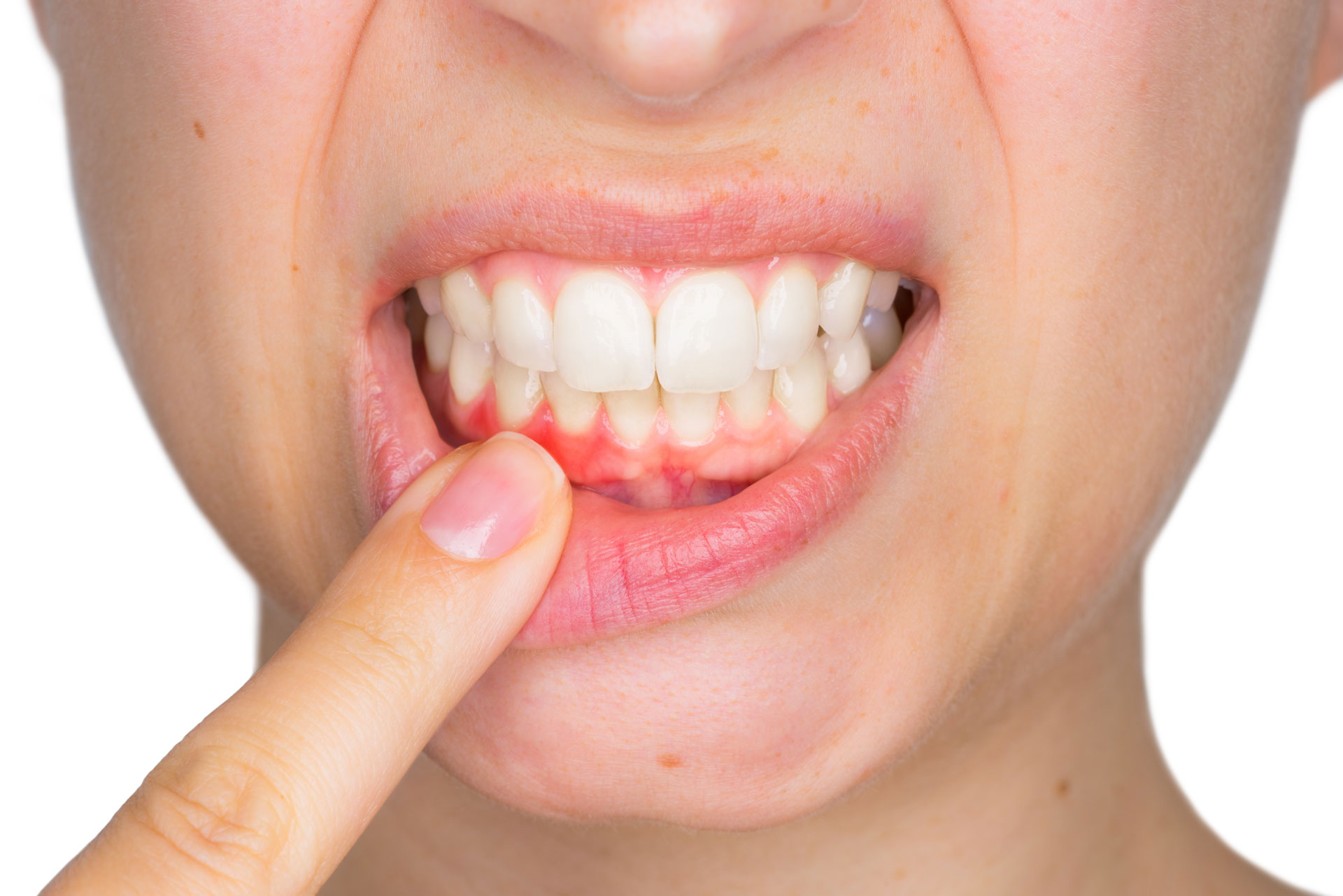 Periodontist