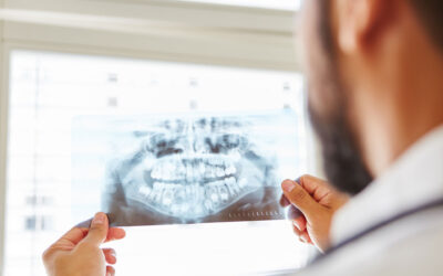 Are your Teeth Floating?