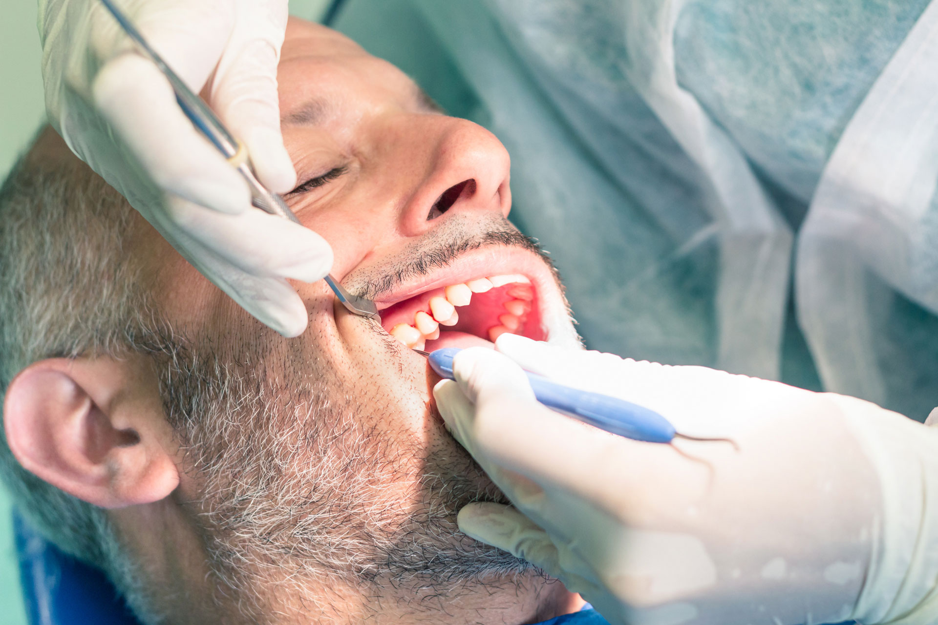 Debridement