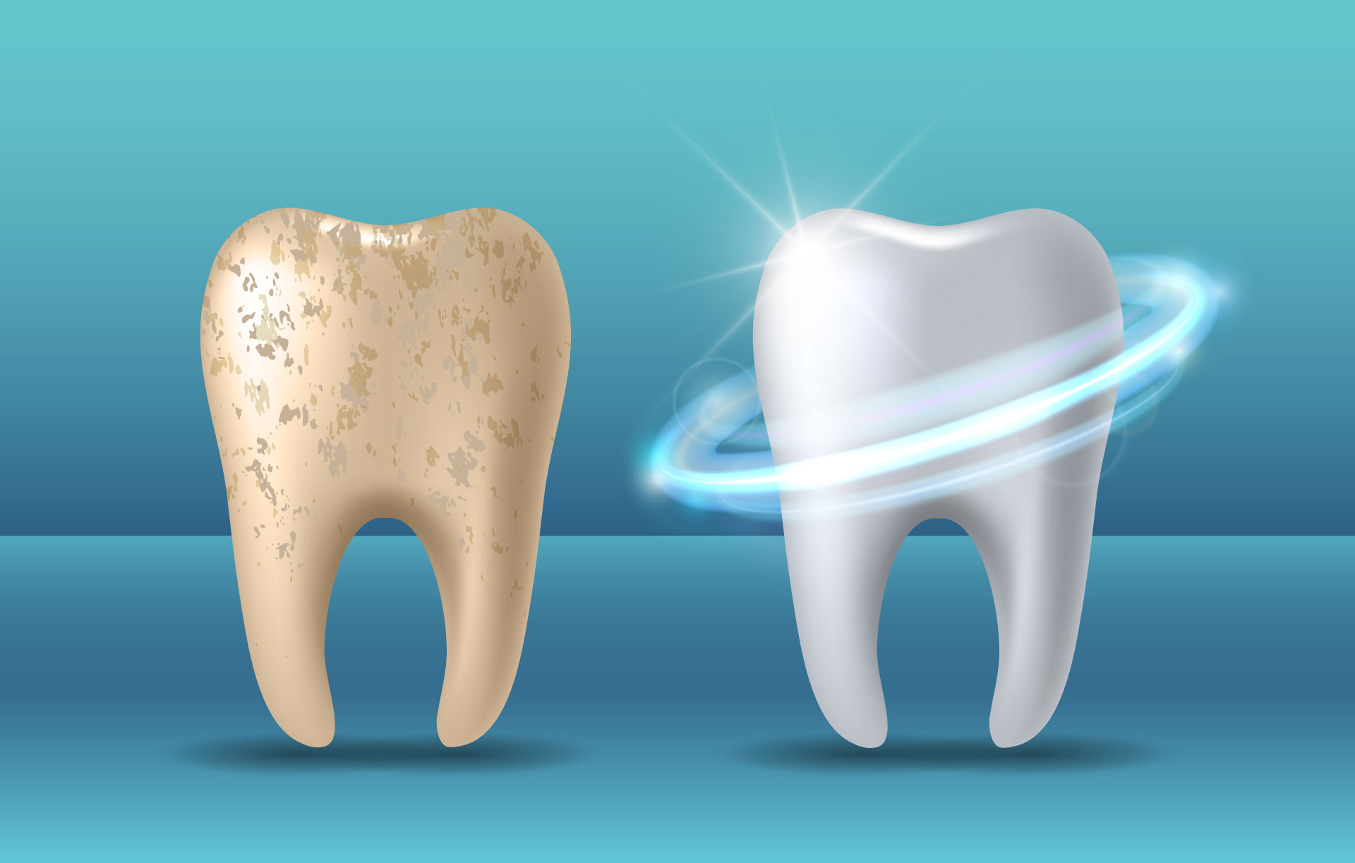 Tooth Enamel