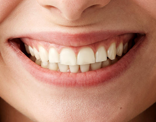Close Up Smile