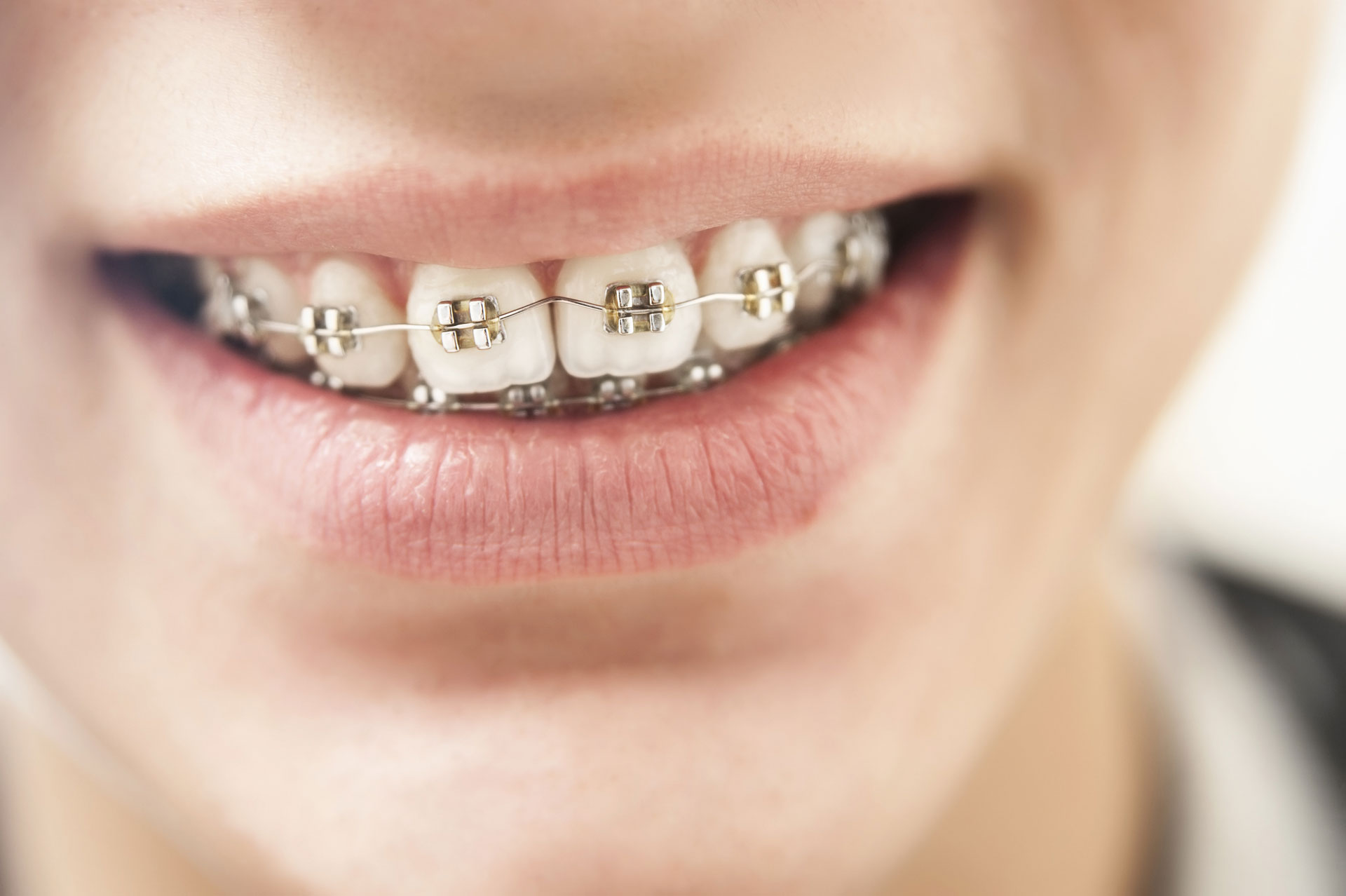 Dental Arches