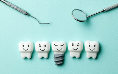 What are Dental Implants?
