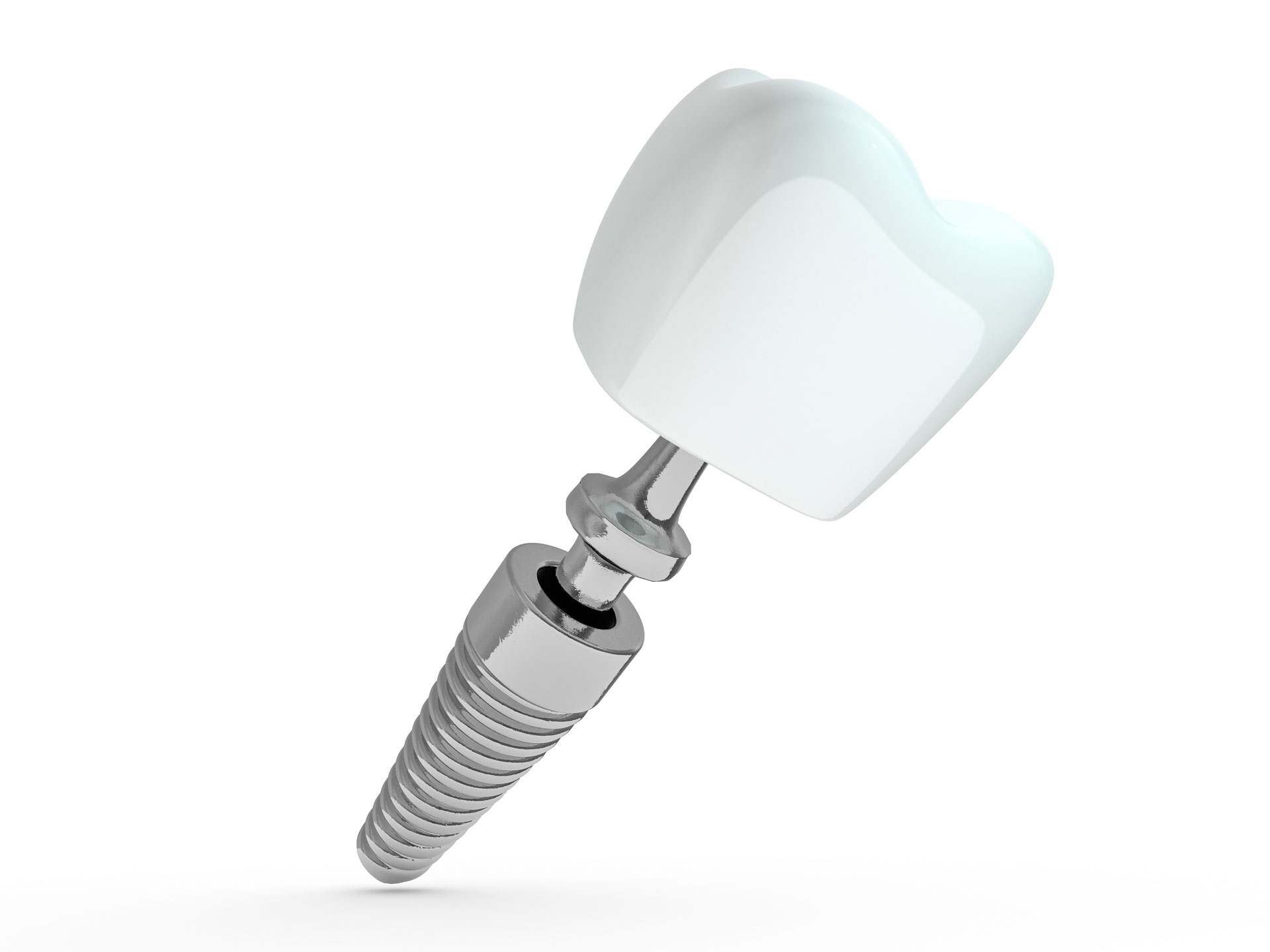 Titanium Dental Implant