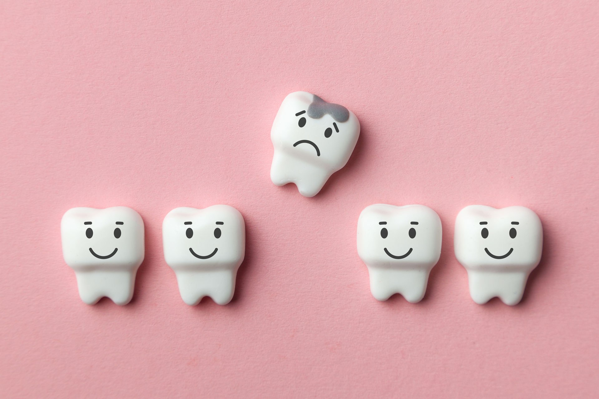 Dental Fillings