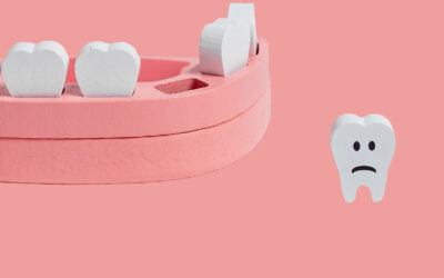 Treating Dental Trauma