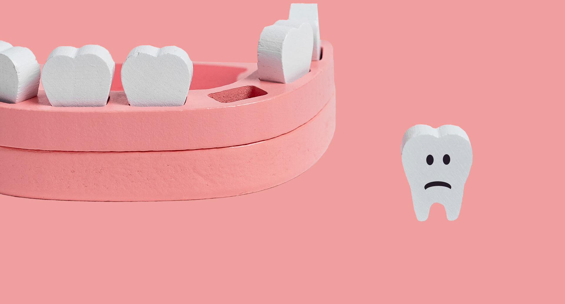 Dental Trauma of Lost Tooth