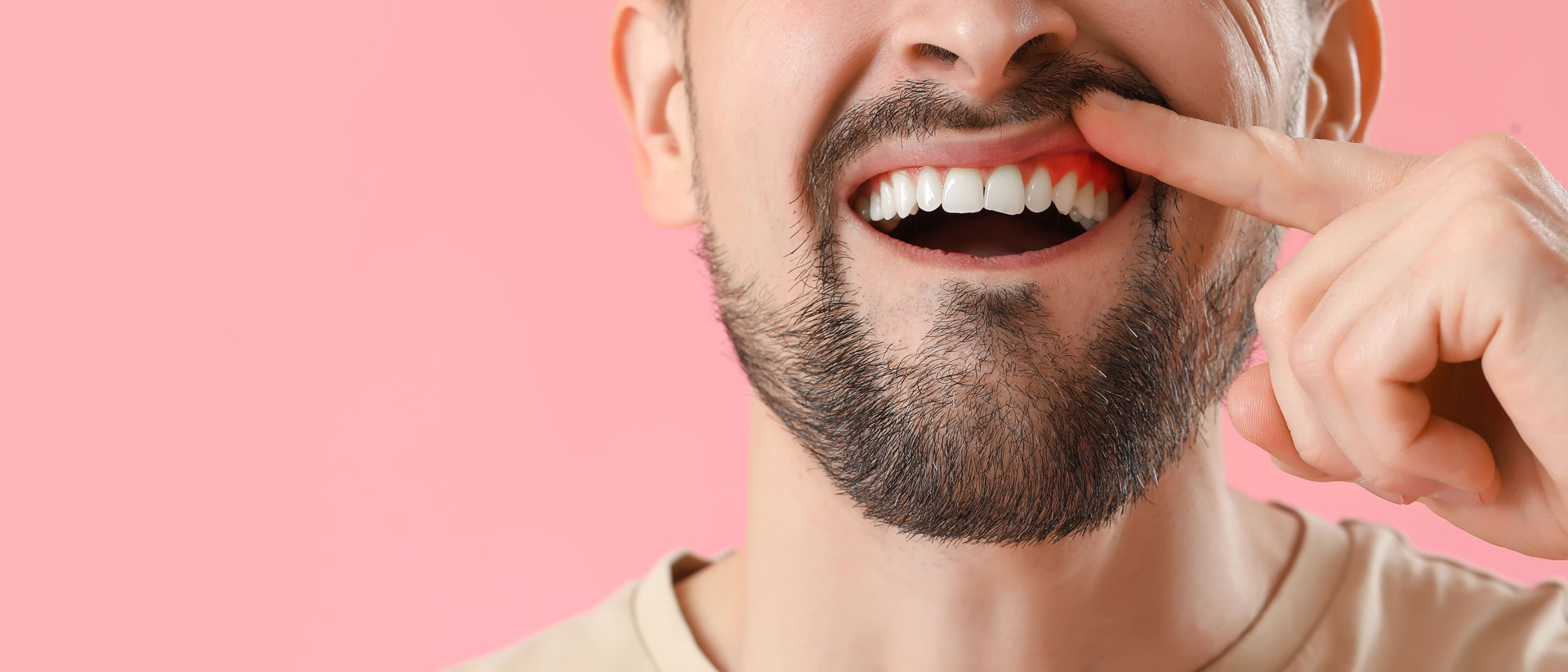 Bleeding Gums