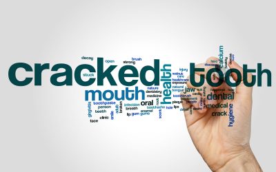 What is Cracked Tooth Syndrome?