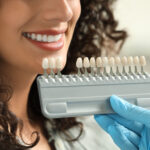 Dentist holding a tooth shade guide next to a smiling patient’s teeth to match color for veneers or whitening.