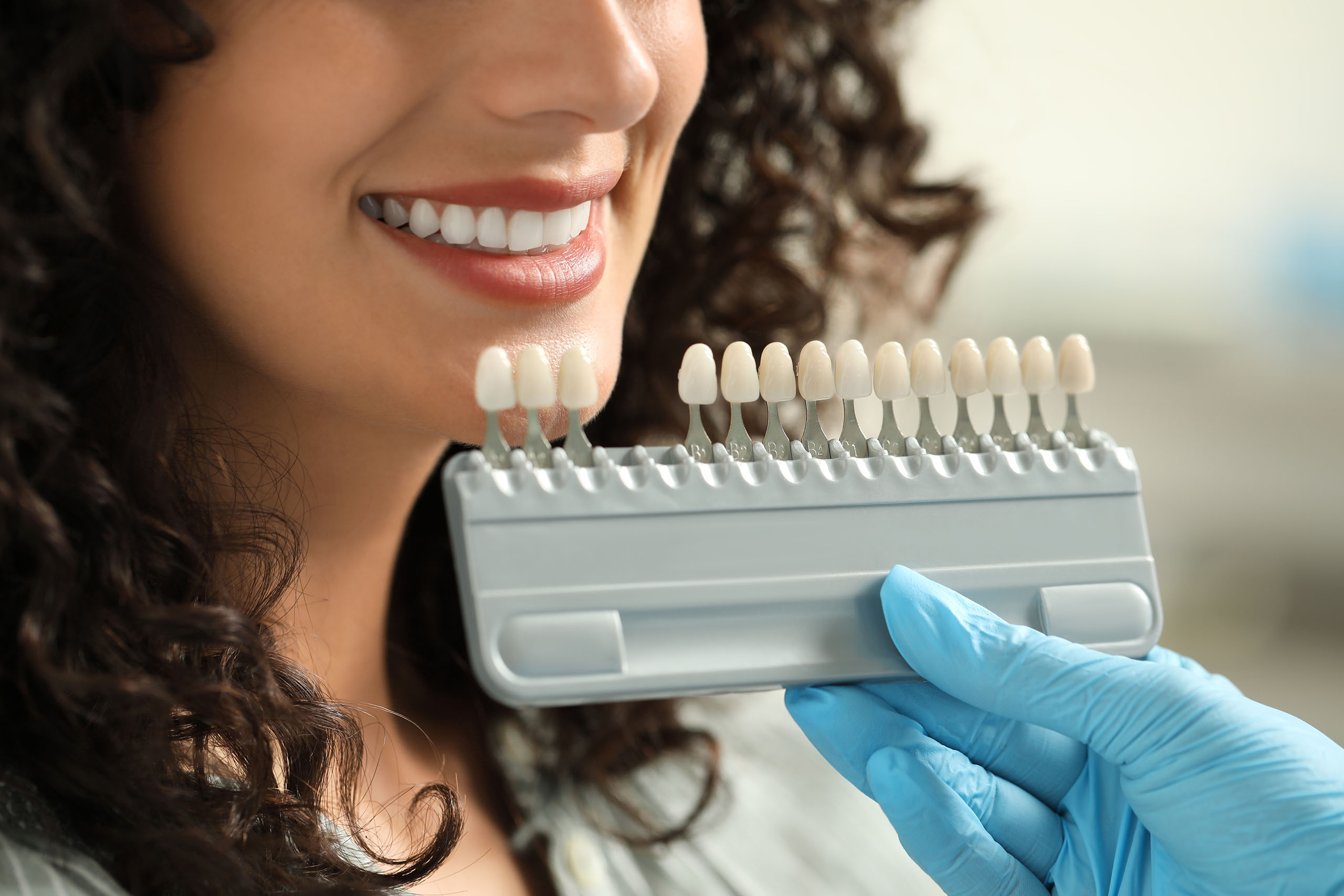 Dentist holding a tooth shade guide next to a smiling patient’s teeth to match color for veneers or whitening.